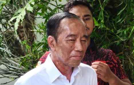 Tidak Cuma Alergi Kulit, Pengamat Sebut Jokowi Alami Gangguan Kejiwaan 